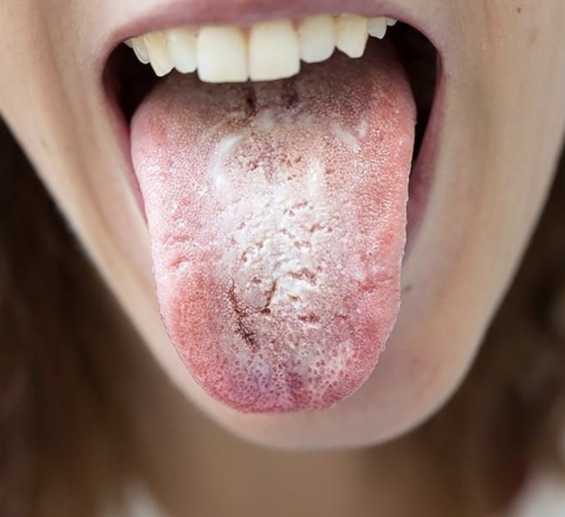 Tongue Reading - Image 2